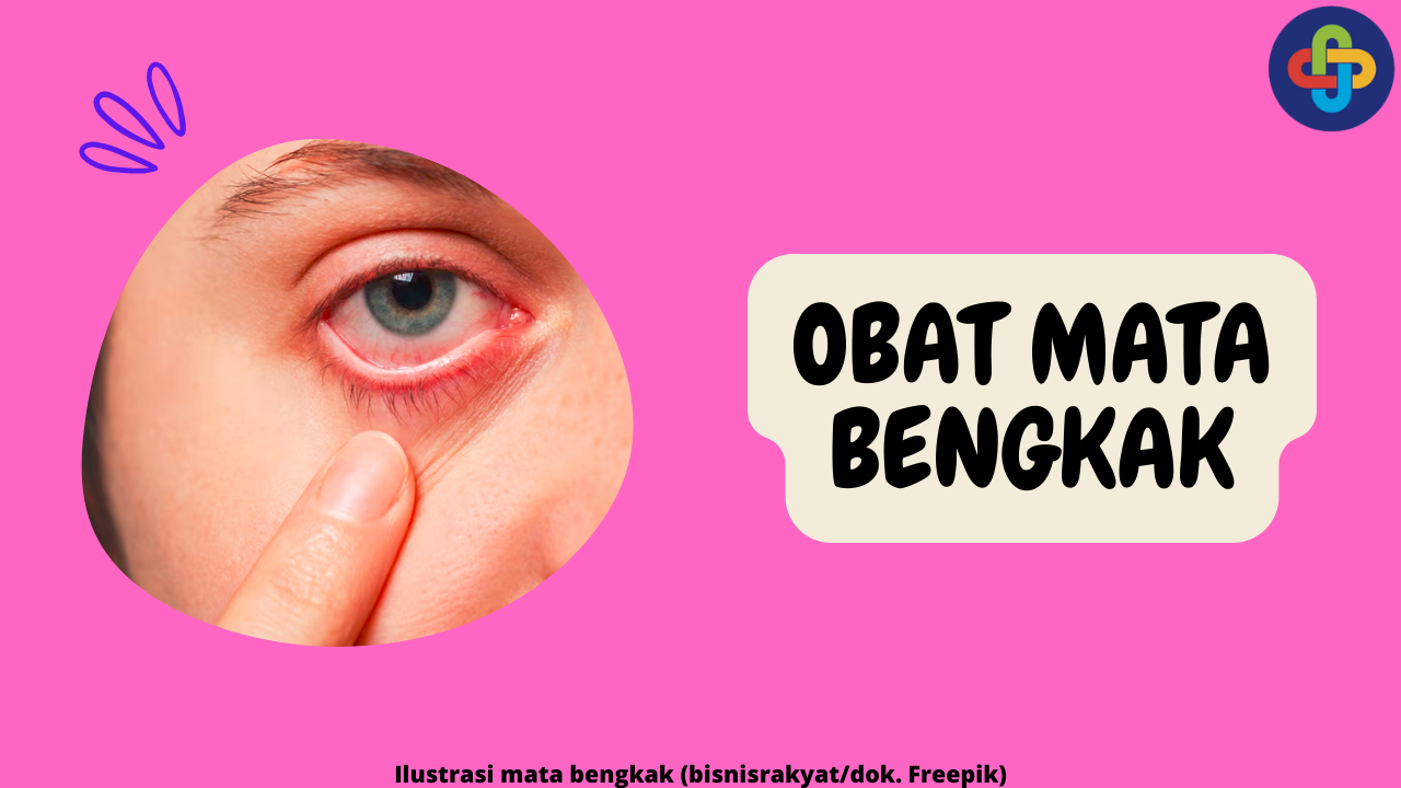 4 Pilihan Obat untuk Mata Bengkak Sesuai dengan Penyebabnya