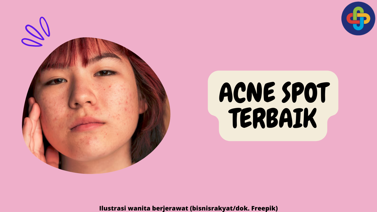 10 Acne Spot Terbaik yang Ampuh Basmi Jerawat